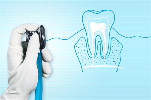 Affordable Root Canal Treatment