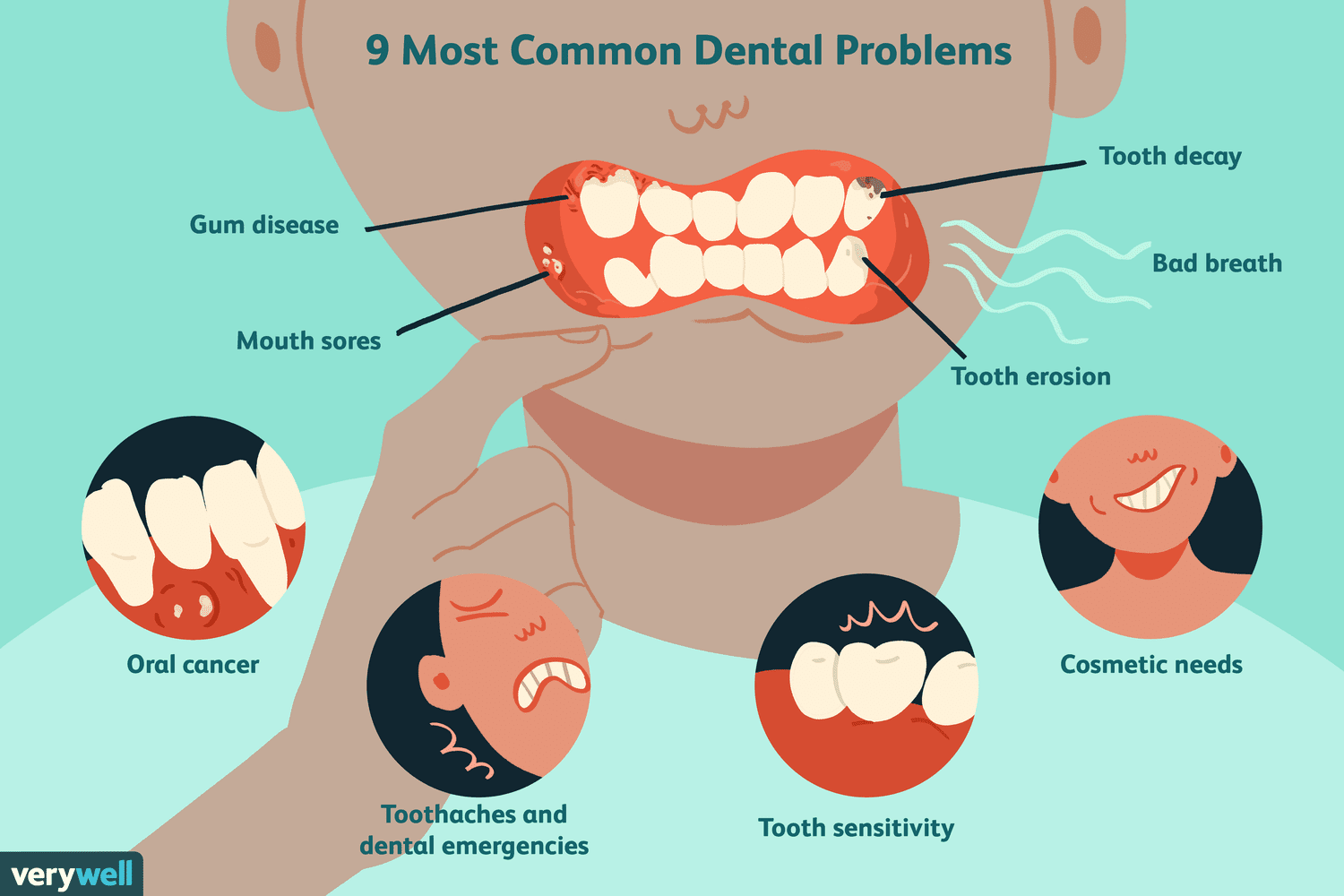 Common Dental Problems and Affordable Solutions