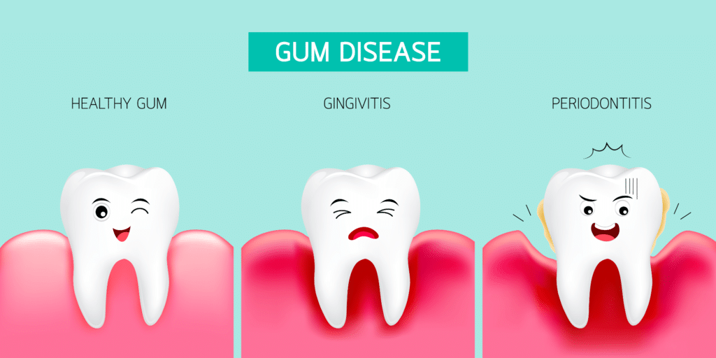 Affordable Gum Disease Treatment: Protecting Your Oral Health