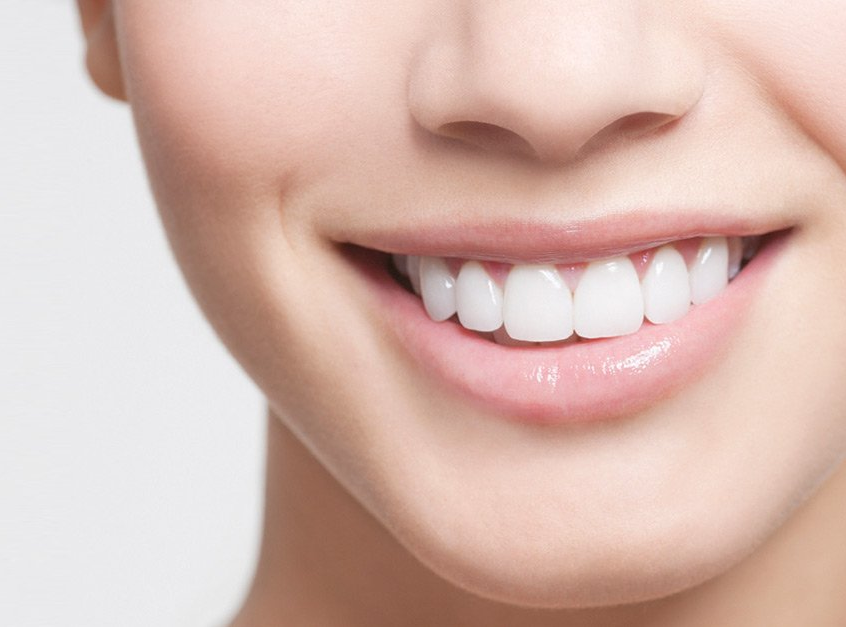 Finding Your Smile Makeover: Affordable Cosmetic Dentistry Options