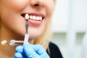 The Affordable Dental Guide to Enhancing Your Smile on a Budget