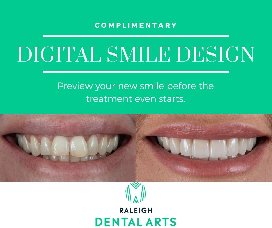 Affordable Smile Design: Customizing Your Dream Smile on a Budget