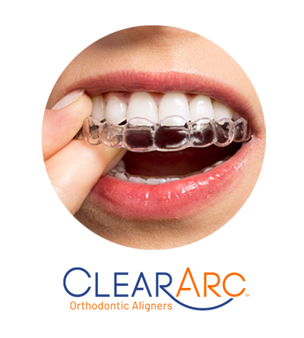 Affordable Invisalign: Discreet Orthodontic Treatment for Adults