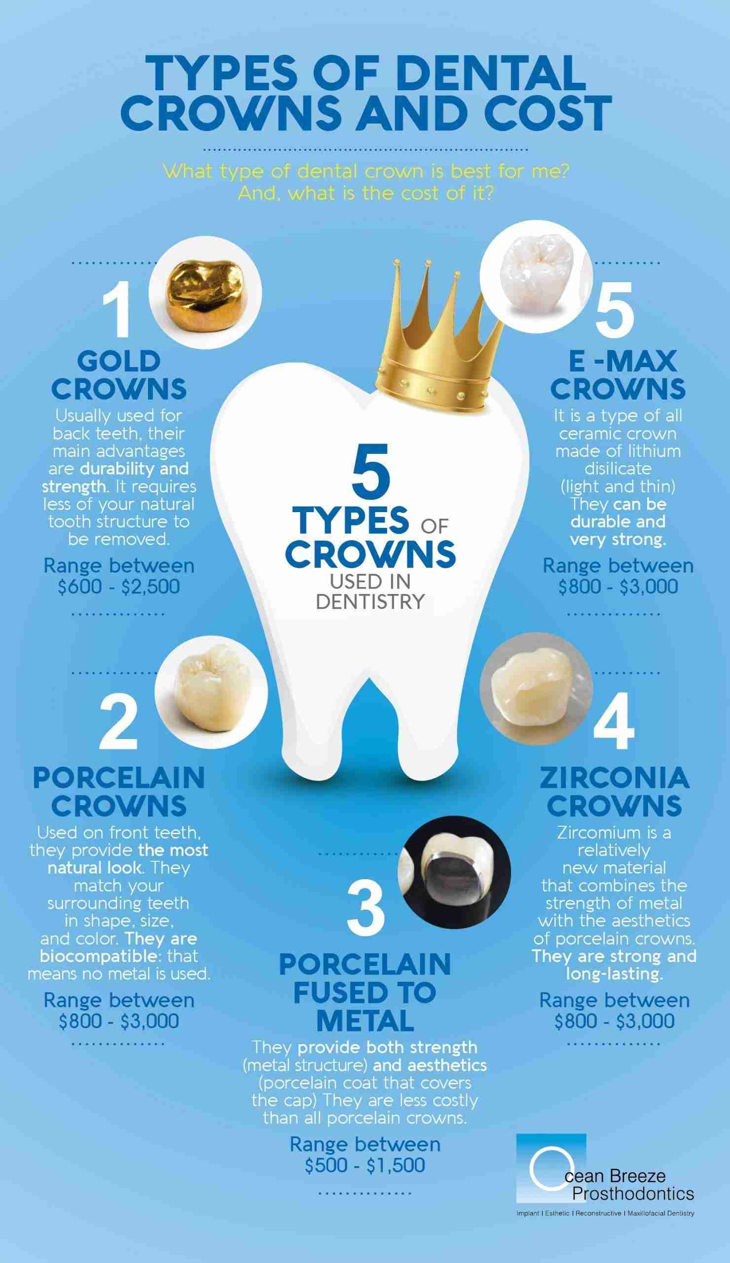 Affordable Dental Crowns: Strengthening and Enhancing Your Teeth