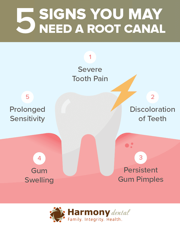 Affordable Emergency Root Canal Services: Quick Relief for Dental Pain