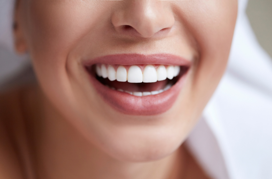 Stratford Teeth Whitening Near You - How Much Does Teeth Whitening Cost  Near Me? - Professional Teeth Whitening Cost in CT