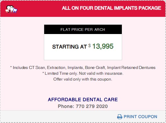 Affordable Dental Access, ALL ON FOUR DENTAL IMPLANTS Coupon Price, Lilburn, GA 30047