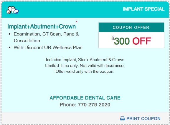 Affordable Dental Access, Implant Special Coupon Price, Lilburn, GA 30047