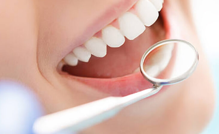 The Benefits of Top-Notch Dental Care for You and Your Family