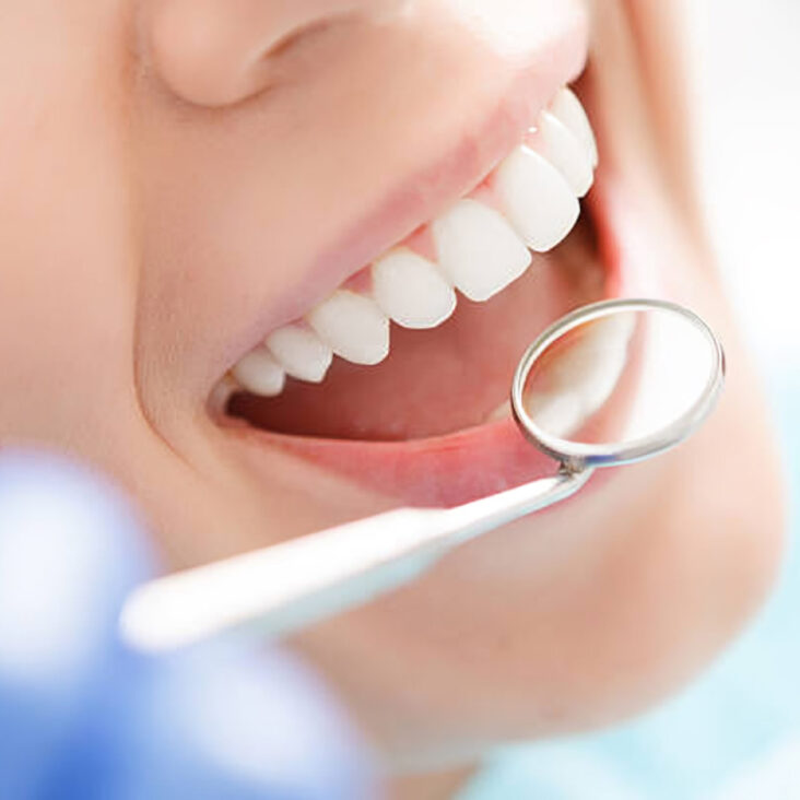 The Benefits of Top-Notch Dental Care for You and Your Family