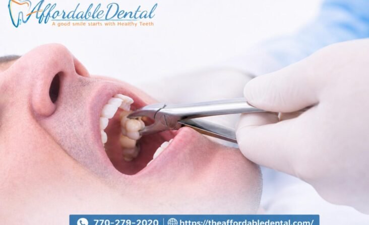 wisdom teeth extraction