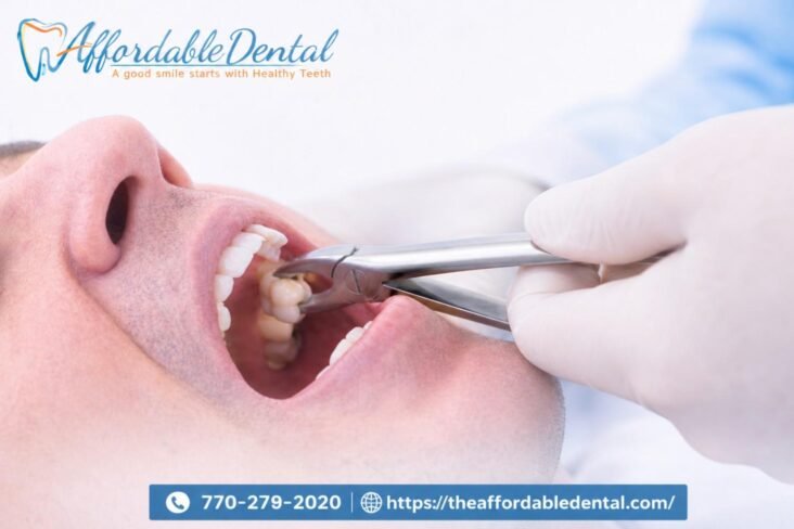 wisdom teeth extraction