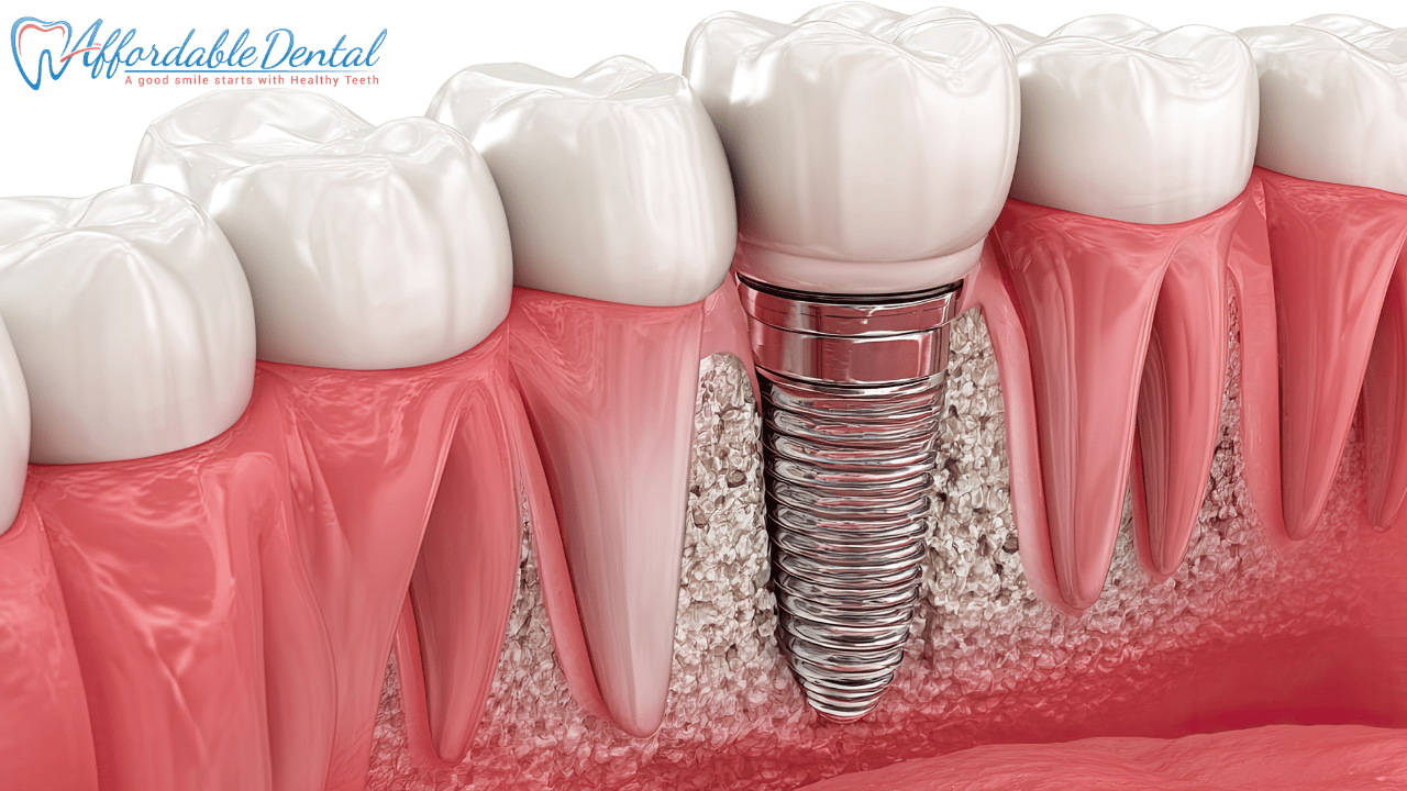 Top tips for maintaining oral health on a tight budget